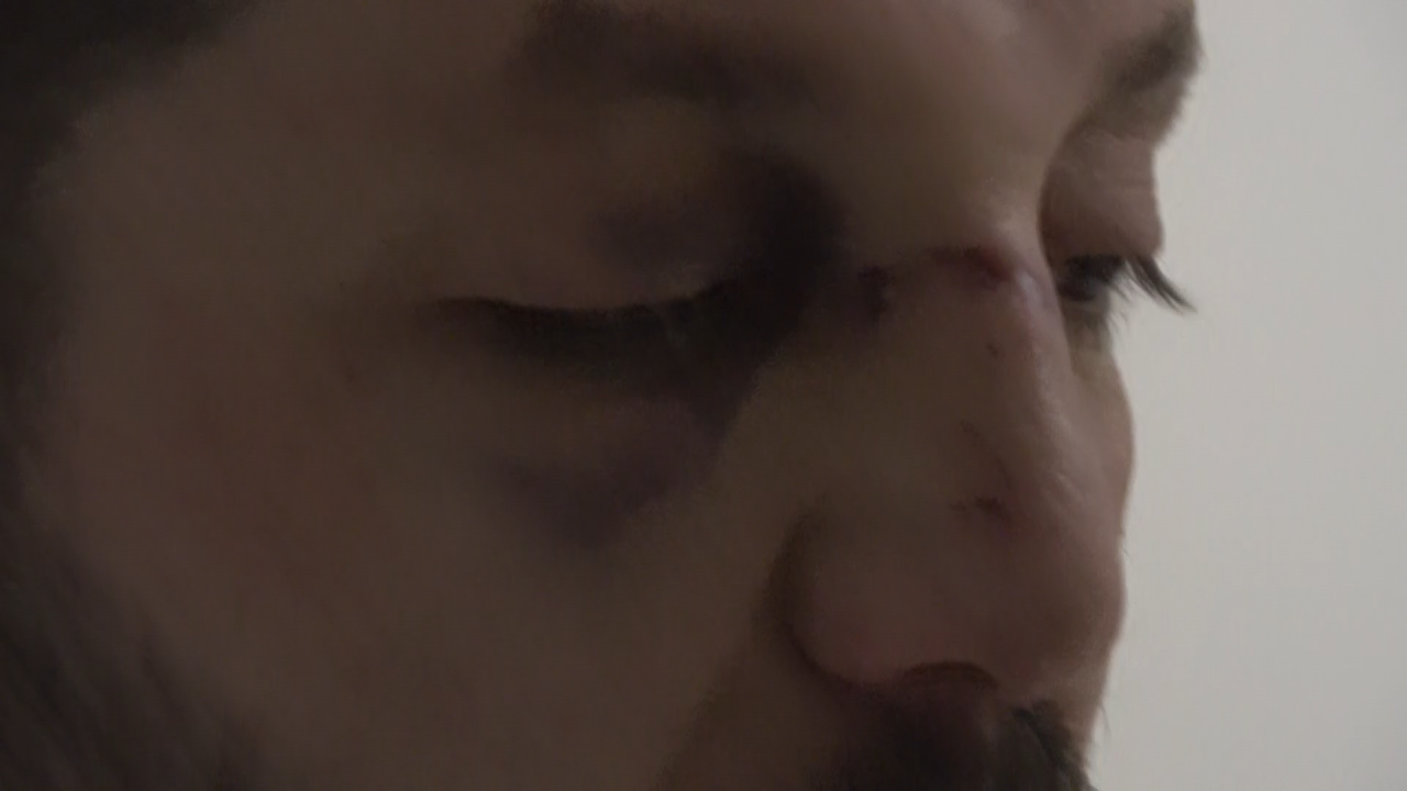 Yalova'daki Vahşette 14 Aylık Bebeğin Kafatasını Çatlattılar! - Sayfa 3