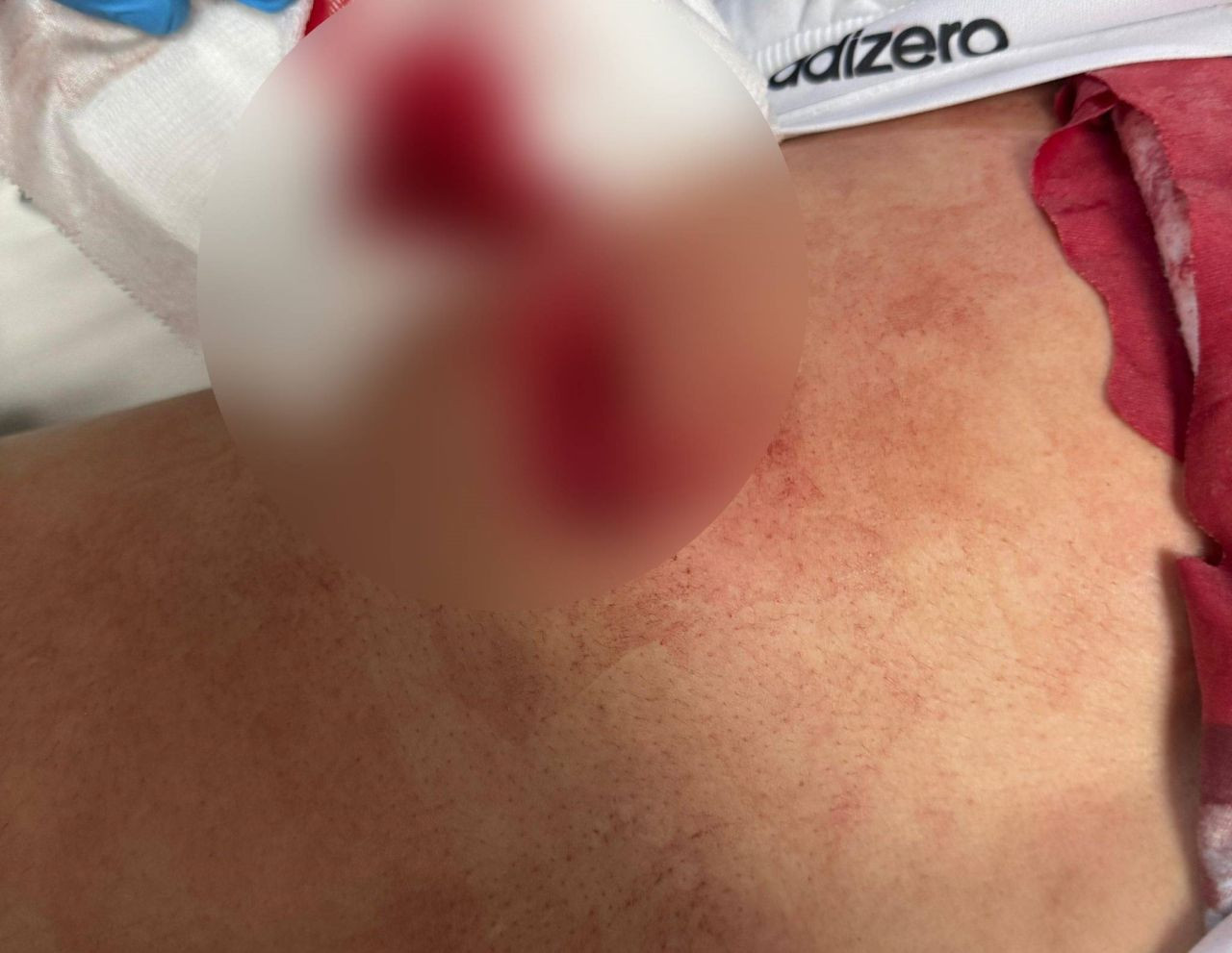 Bursa'da Parkta Çıkan Tartışma Kanlı Bitti! - Sayfa 2