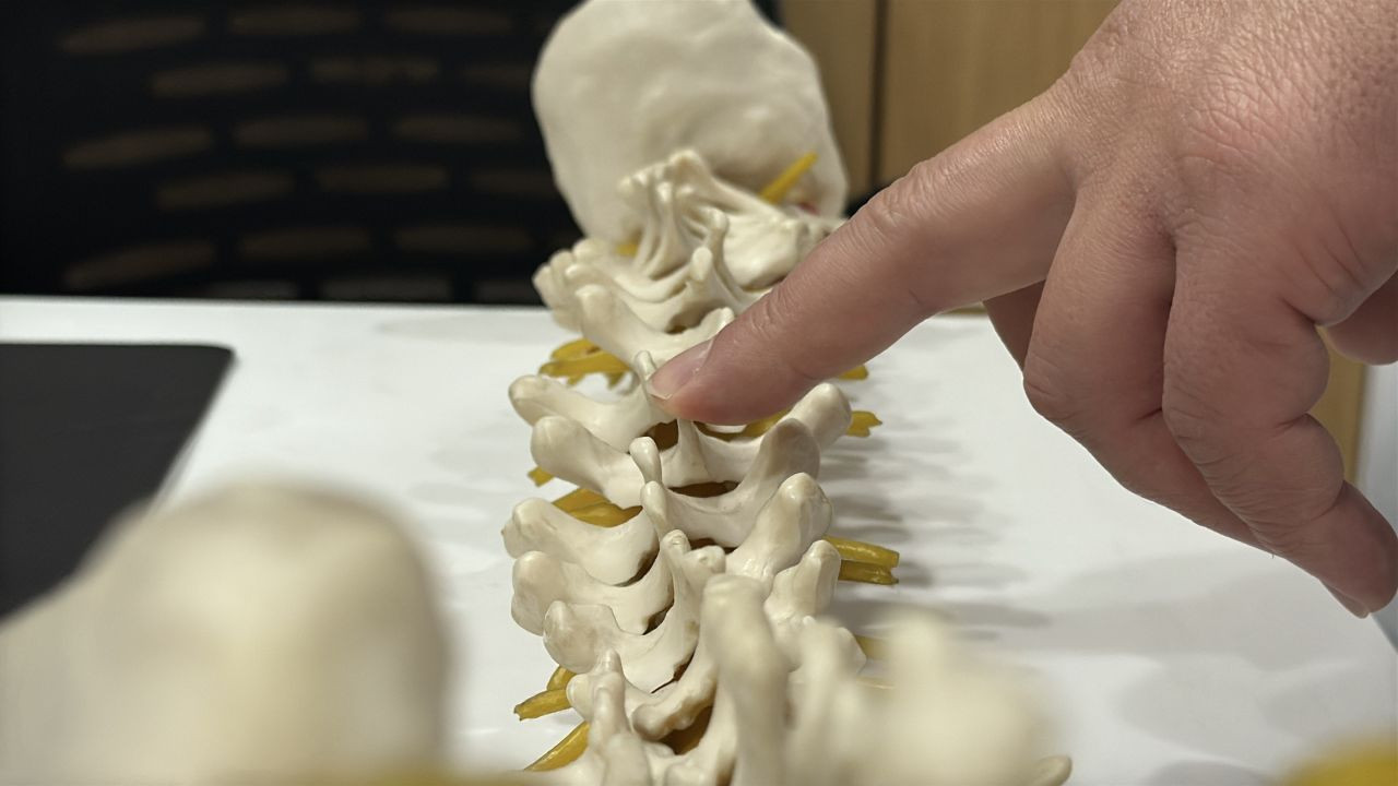 Beldeki Sinsi Tehlike: Spinal Stenoz Günlük Yaşamı Kısıtlıyor - Sayfa 4